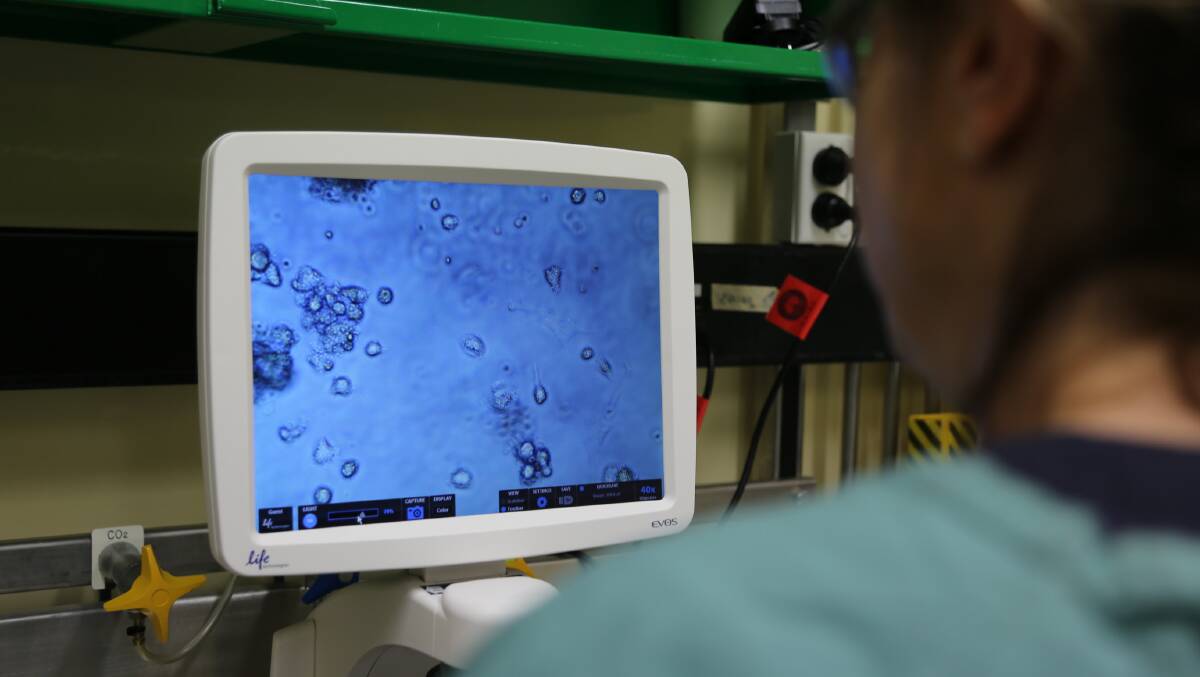 African swine fever seen under the microscope at the Australian Centre for Disease Preparedness. Picture supplied